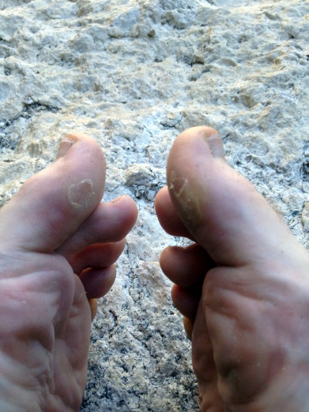Big toe bigwall blisters at Texas Flake